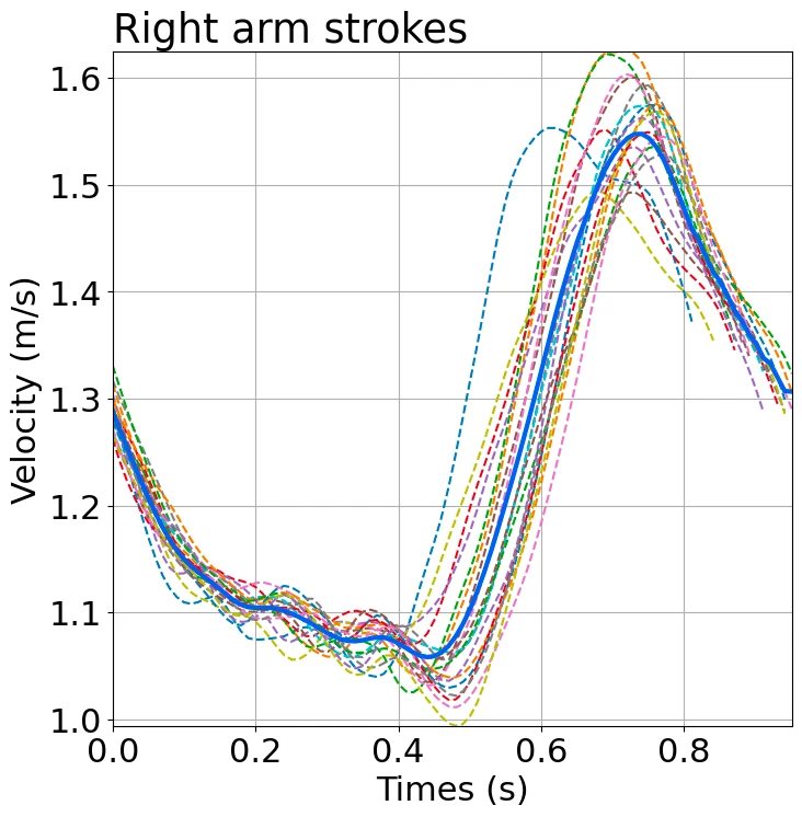 Graph of the speed changes (right arm)