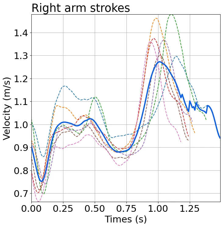Graph of the speed changes (right arm)