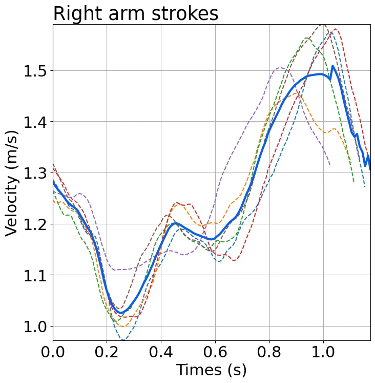 Graph of the speed changes (right arm)