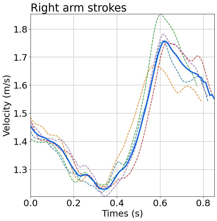 Graph of the speed changes (right arm)